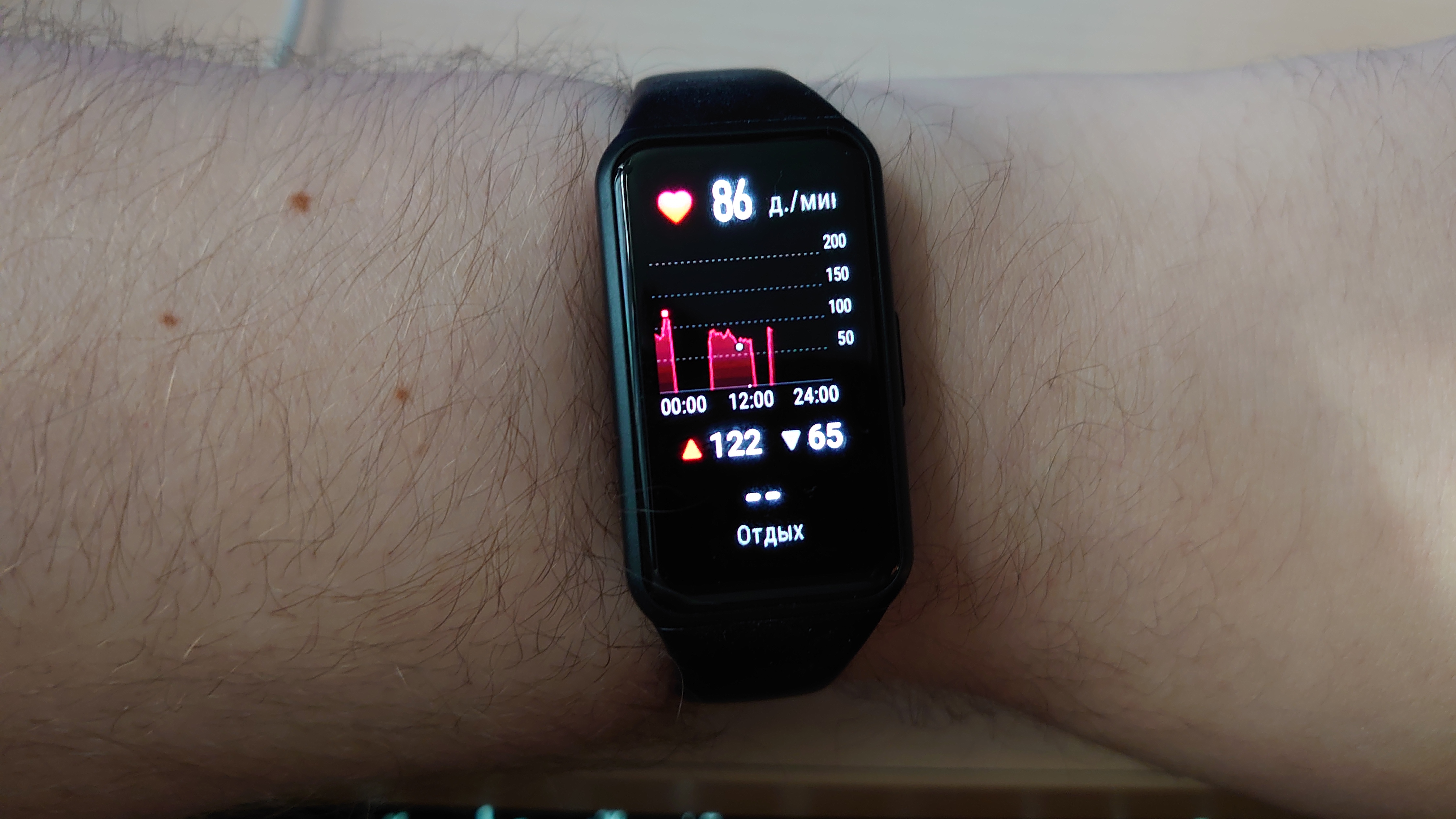 Обзор Honor Band 6. Удобный фитнес-браслет в дизайне «умных» часов - фото 6